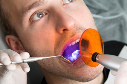 carie dente dentista odontoiatra colle val d elsa poggibonsi otturazione